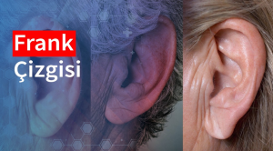 Kulak Memesindeki ‘Frank İşareti’ Kalp Krizi Belirtisi mi?